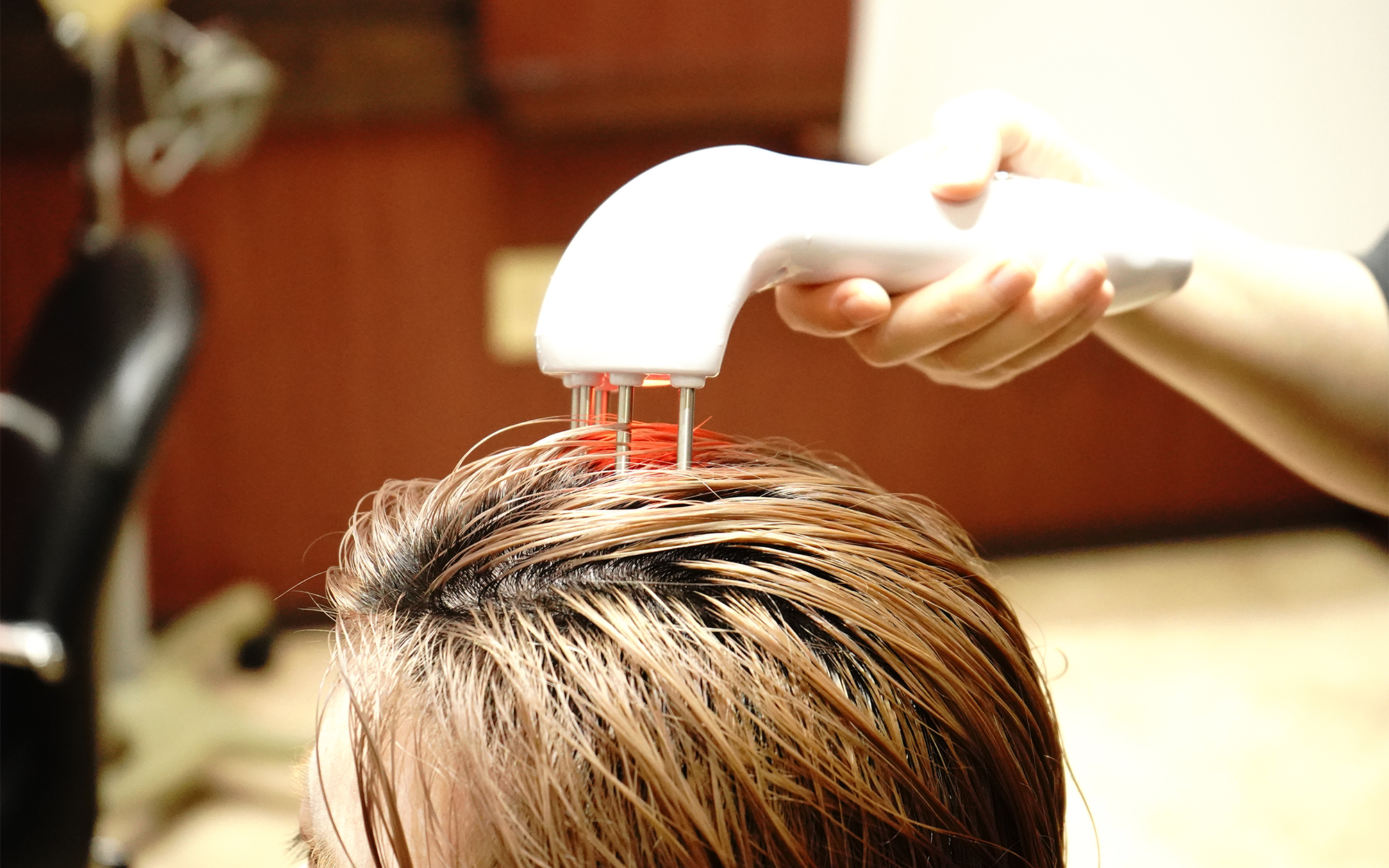 スキャルプケア